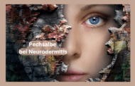 Pechsalbe bei Neurodermitis: Die Wirkung von Pechsalbe bei Neurodermitis oder Schuppenflechte