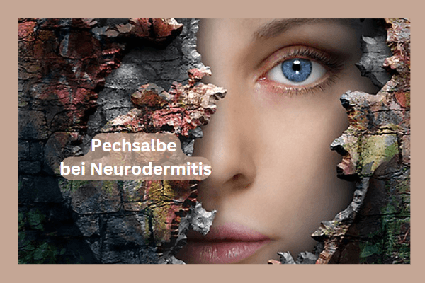 Pechsalbe bei Neurodermitis: Die Wirkung von Pechsalbe bei Neurodermitis oder Schuppenflechte